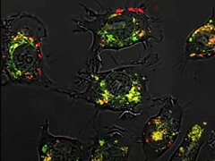 Graças aos ácidos nucleicos esféricos, o composto 5-fluorouracil foi 20.000 vezes mais eficaz do que o normal em estudos com animais. (Fonte da imagem: Northwestern University)