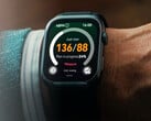 O Watch D2 já tem quase dois anos.