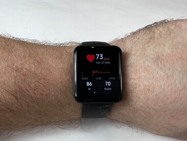 redmi watch esportivo