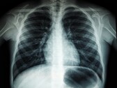 Uma imagem de raio X de um torso humano (Fonte da imagem: Umanoide via Unsplash; cortada)