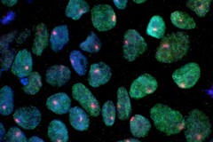 Uma imagem mostrando células-tronco obtidas da pele de uma mulher (Fonte da imagem: UCLA via CIRM)