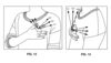 Uma patente da Fitbit mostra detalhes de um potencial monitor de pressão arterial no dedo. (Fonte da imagem: USPTO)