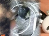 A explosão fatal dos fones de ouvido é a mais recente falha chocante de dispositivo envolvendo equipamento de áudio pessoal. (Fonte de imagem: Neowin/Times of India/WFLA - editado)