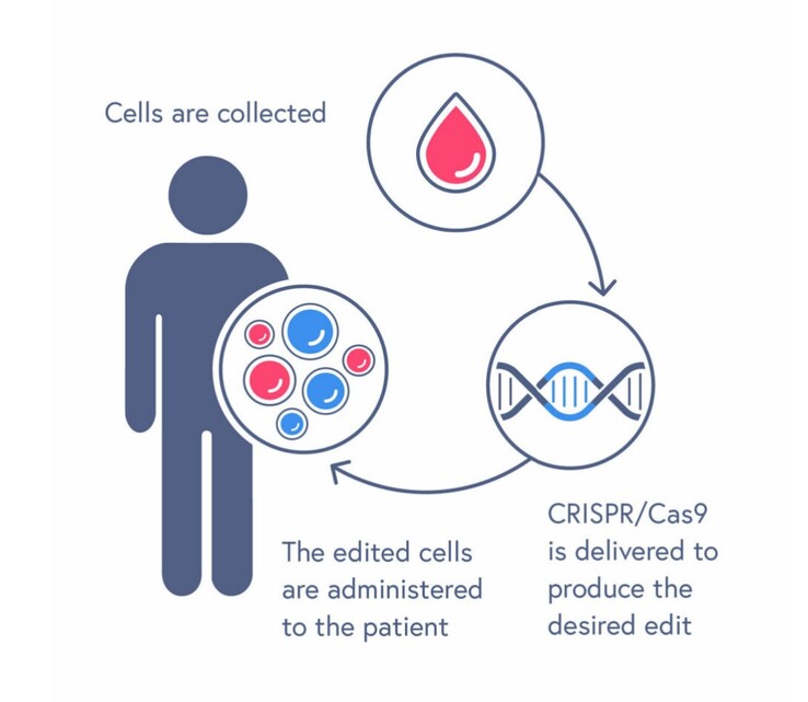 O processo de tratamento do CASGEVY envolve a transfusão de células-tronco sanguíneas editadas. (Fonte: CRISPR Therapeutics)