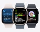 o watchOS 26 chegou, trazendo uma série de novos recursos para o Apple Watch. (Fonte da imagem: Apple)