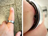 Um Samsung Galaxy Ring com uma bateria inchada forçou um usuário a ir ao hospital. (Fonte da imagem: Zone of Tech)