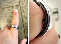 Um Samsung Galaxy Ring com uma bateria inchada forçou um usuário a ir ao hospital. (Fonte da imagem: Zone of Tech)