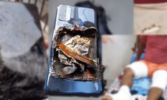 O Oppo A53 supostamente explodiu, deixando seu proprietário com ferimentos em ambas as pernas. (Fonte de imagem: Dost técnico - editado)