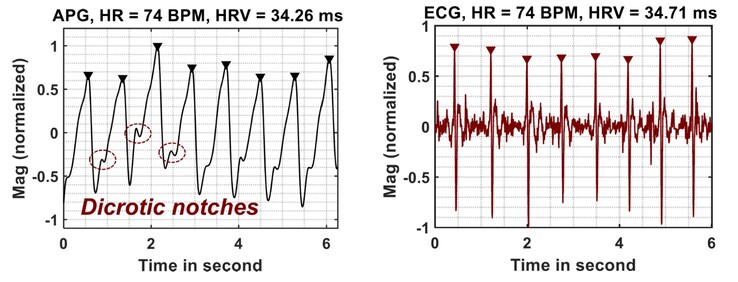 As leituras de APG se comparam favoravelmente com as do ECG (Fonte da imagem: Google Research)