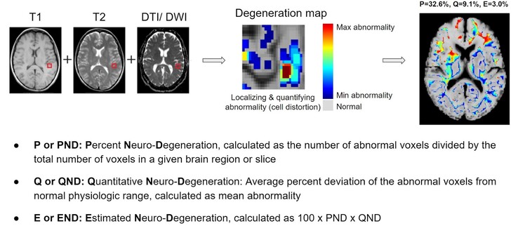 O BrainSee pode detectar áreas anômalas do cérebro a partir de um exame de ressonância magnética e fornecer aos médicos uma pontuação que indica a probabilidade de um paciente desenvolver Alzheimer. (Fonte: Darmiyan)