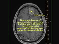 Um exame de ressonância magnética de Michael Prinke, carregado por sua esposa na mídia social