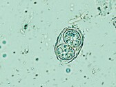 Toxoplasma gondii mostrado aqui em sua forma infecciosa de ovo. (Fonte da imagem: Todorean Gabriel/iStock/Getty Images Plus)