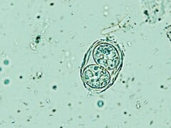 Toxoplasma gondii mostrado aqui em sua forma infecciosa de ovo. (Fonte da imagem: Todorean Gabriel/iStock/Getty Images Plus)