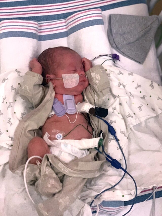 Sensor de som da NWU em bebê prematuro para monitorar a função pulmonar. (Fonte: Northwestern University)