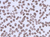 Células vermelhas do sangue formando rouleaux. (Fonte da imagem: Wikimedia Commons)