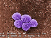 A Integrated Biosciences descobre uma nova classe de antibióticos eficazes contra a bactéria MRSA resistente. (Fonte: Public Health Image Library #9994)