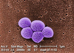 A Integrated Biosciences descobre uma nova classe de antibióticos eficazes contra a bactéria MRSA resistente. (Fonte: Public Health Image Library #9994)