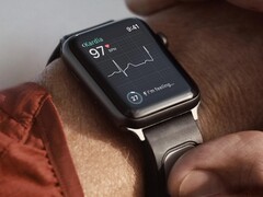 A KardiaBand é uma pulseira de monitoramento de ECG projetada para o Apple Watch. (Fonte da imagem: Kardia)