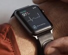 A KardiaBand é uma pulseira de monitoramento de ECG projetada para o Apple Watch. (Fonte da imagem: Kardia)