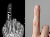 Bone Biologics registra patente para nova tecnologia de regeneração óssea (Fonte da imagem: imagem ilustrativa gerada por IA)
