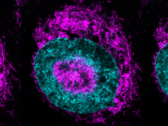 Uma célula cancerosa confinada (foto) - as mitocôndrias de cor magenta podem ser vistas se acumulando na periferia nuclear de cor ciano e dentro de indentações nucleares. (Fonte da imagem/capítulo: Rito Ghose e Fabio Pezzano/Centro de Regulación Genómica)