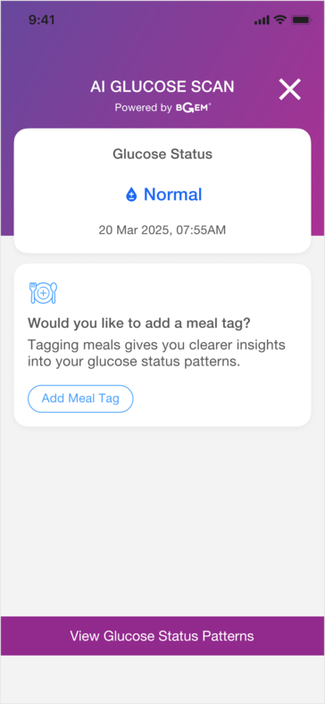 O anel inteligente pode ser útil para descobrir ligações entre determinados alimentos e o nível de açúcar no sangue do usuário