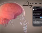 A visão da Neuralink: controle total dos dispositivos digitais por meio do pensamento (Fonte da imagem: Neuralink)