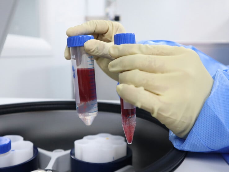 Os laboratórios de exames de sangue estavam entre os serviços do NHS que foram interrompidos pelo ataque cibernético à cadeia de suprimentos da Synnovis (Fonte da imagem: Unsplash/Malcolm Choong)