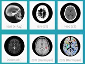 O software de IA médica BrainSee da Darmiyan pode detectar sinais de Alzheimer logo no início. (Fonte: Darmiyan)