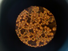 Células sanguíneas em um microscópio (Fonte da imagem: ThisisEngineering via Unsplash; cortado)