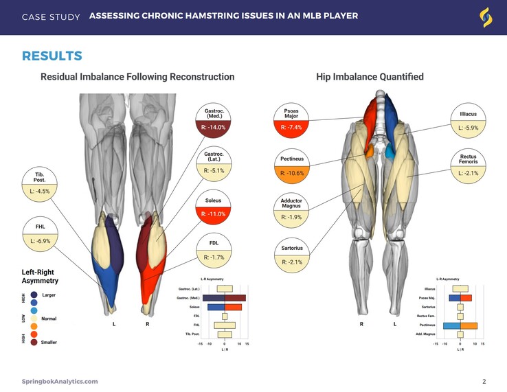 Os relatórios do Springbok Analytics detalham os músculos individuais por meio de exames de ressonância magnética em 3D. (Fonte: Springbok Analytics)