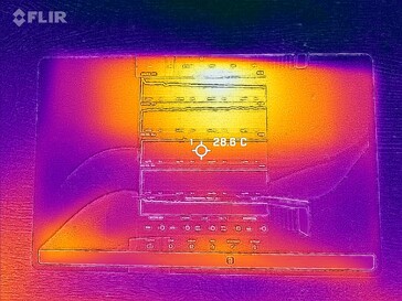 Imagem térmica: frontal