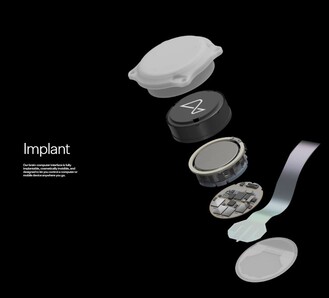 Os vários componentes do implante Neuralink. (Fonte: Neuralink)